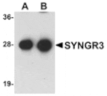 Western blot - SYNGR3 Antibody from Signalway Antibody (25036) - Antibodies.com