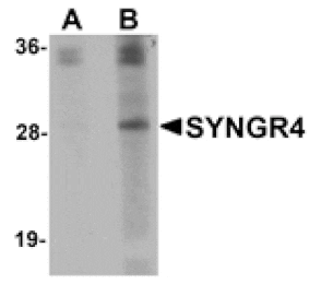Western blot - SYNGR4 Antibody from Signalway Antibody (25037) - Antibodies.com