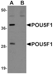 Western blot - POU5F1 Antibody from Signalway Antibody (25043) - Antibodies.com