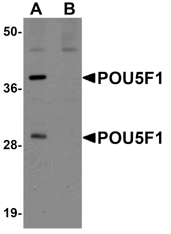 Western blot - POU5F1 Antibody from Signalway Antibody (25043) - Antibodies.com