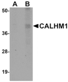 Western blot - CALHM1 Antibody from Signalway Antibody (25049) - Antibodies.com