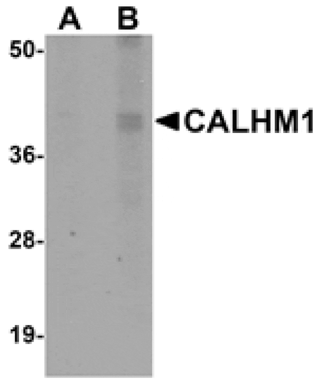 Western blot - CALHM1 Antibody from Signalway Antibody (25049) - Antibodies.com