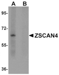 Western blot - ZSCAN4 Antibody from Signalway Antibody (25058) - Antibodies.com