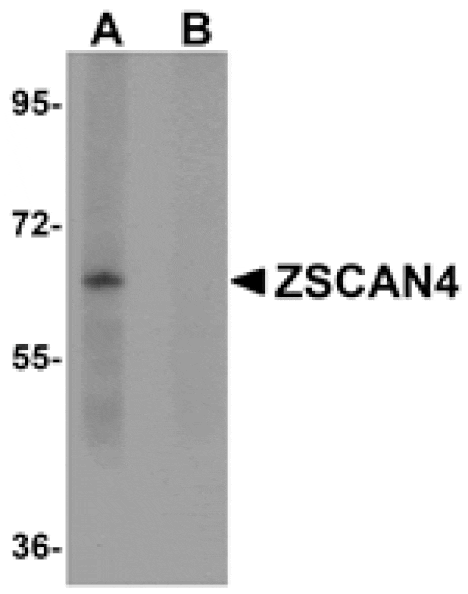 Western blot - ZSCAN4 Antibody from Signalway Antibody (25058) - Antibodies.com