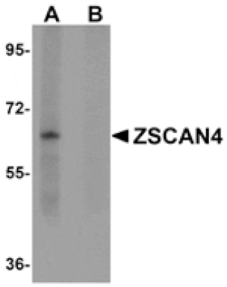 Western blot - ZSCAN4 Antibody from Signalway Antibody (25058) - Antibodies.com
