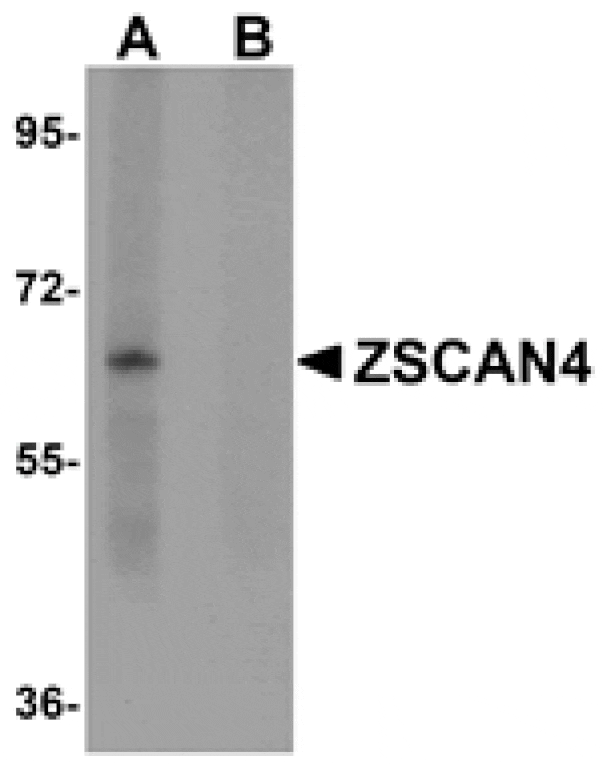 Western blot - ZSCAN4 Antibody from Signalway Antibody (25058) - Antibodies.com