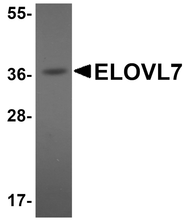 Western blot - ELOVL7 Antibody from Signalway Antibody (25071) - Antibodies.com