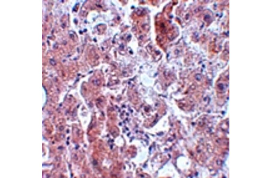 Immunohistochemistry - ELOVL7 Antibody from Signalway Antibody (25071) - Antibodies.com