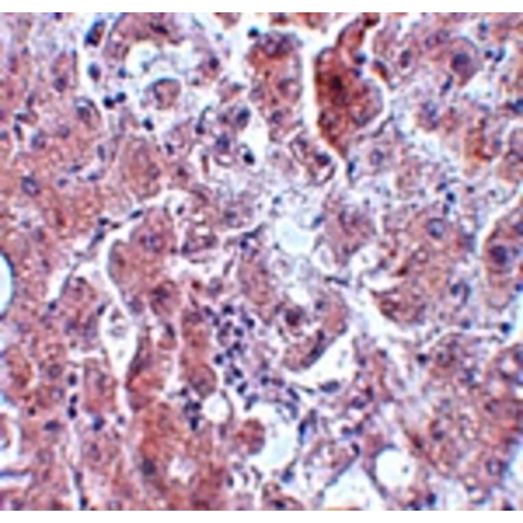 Immunohistochemistry - ELOVL7 Antibody from Signalway Antibody (25071) - Antibodies.com