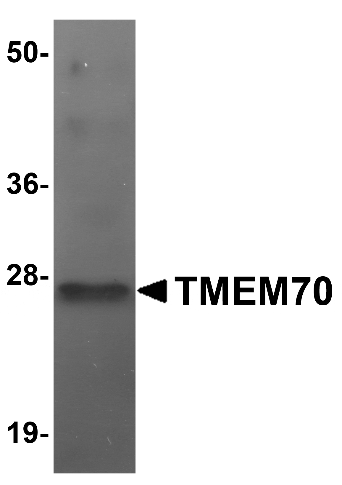 Western blot analysis of TMEM70 in human liver tissue lysate with TMEM70 antibody at 1 µg/mL.