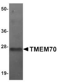 Western blot - TMEM70 Antibody from Signalway Antibody (25073) - Antibodies.com