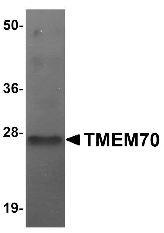 Western blot - TMEM70 Antibody from Signalway Antibody (25073) - Antibodies.com