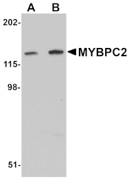 Western blot - MYBPC2 Antibody from Signalway Antibody (25075) - Antibodies.com