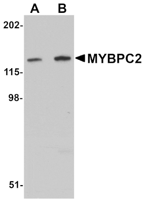 Western blot - MYBPC2 Antibody from Signalway Antibody (25075) - Antibodies.com