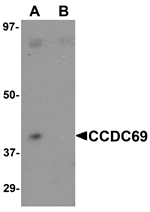 Western blot analysis of CCDC69 in mouse lung tissue lysate with CCDC69 antibody at 1 µg/mL in (A) the absence and (B) the presence of blocking peptide.