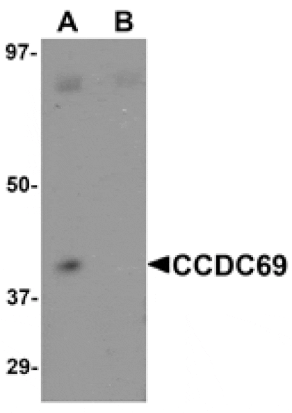 Western blot - CCDC69 Antibody from Signalway Antibody (25093) - Antibodies.com