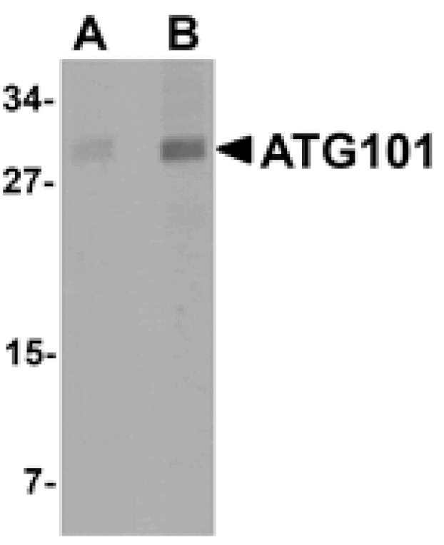 Western blot - ATG101 Antibody from Signalway Antibody (25133) - Antibodies.com