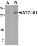 Western blot - ATG101 Antibody from Signalway Antibody (25133) - Antibodies.com