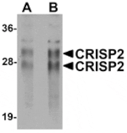 Western blot - CRISP2 Antibody from Signalway Antibody (25165) - Antibodies.com