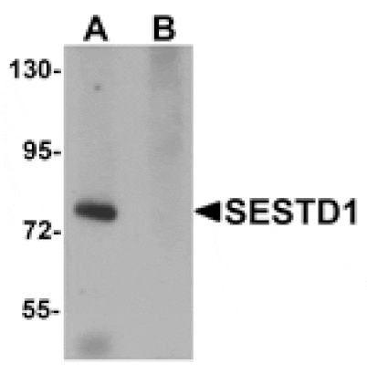 Western blot - SESTD1 Antibody from Signalway Antibody (25167) - Antibodies.com