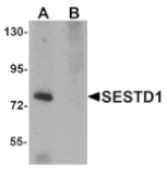 Western blot - SESTD1 Antibody from Signalway Antibody (25167) - Antibodies.com