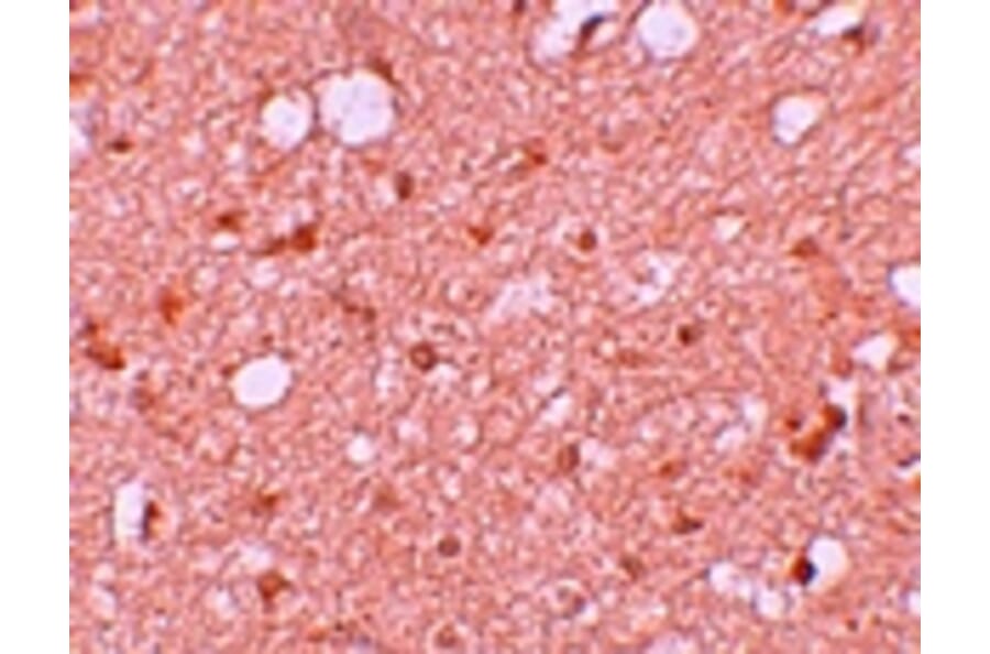 Immunohistochemistry - SESTD1 Antibody from Signalway Antibody (25167) - Antibodies.com