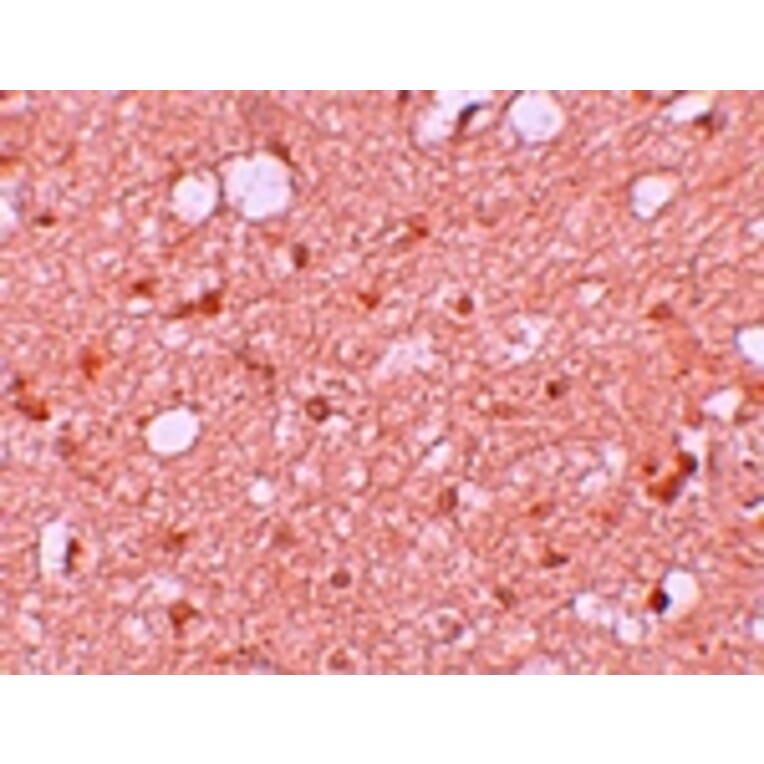 Immunohistochemistry - SESTD1 Antibody from Signalway Antibody (25167) - Antibodies.com