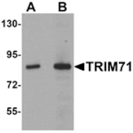 Western blot - TRIM71 Antibody from Signalway Antibody (25169) - Antibodies.com