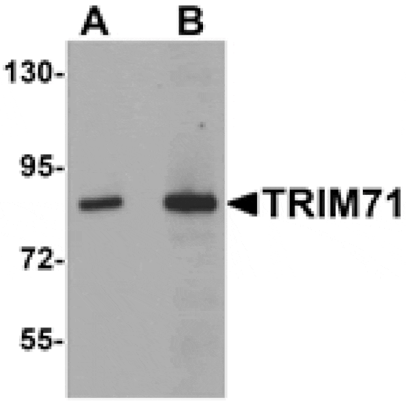 Western blot - TRIM71 Antibody from Signalway Antibody (25169) - Antibodies.com