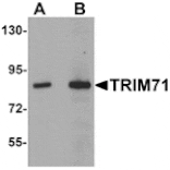 Western blot - TRIM71 Antibody from Signalway Antibody (25169) - Antibodies.com