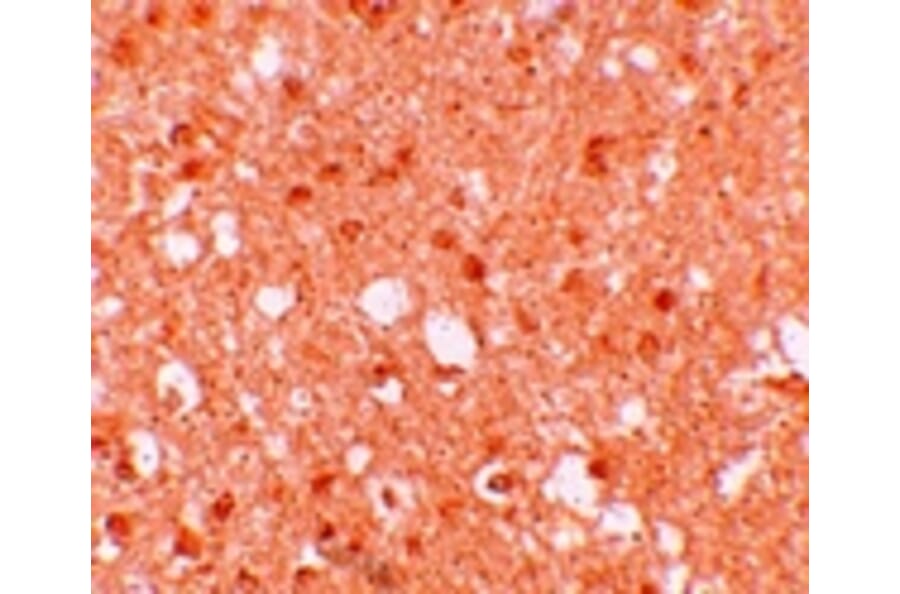 Immunohistochemistry - TRIM71 Antibody from Signalway Antibody (25169) - Antibodies.com