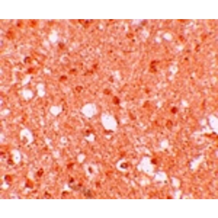Immunohistochemistry - TRIM71 Antibody from Signalway Antibody (25169) - Antibodies.com