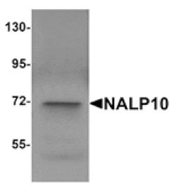 Western blot - NALP10 Antibody from Signalway Antibody (25184) - Antibodies.com