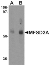 Western blot - MFSD2A Antibody from Signalway Antibody (25208) - Antibodies.com