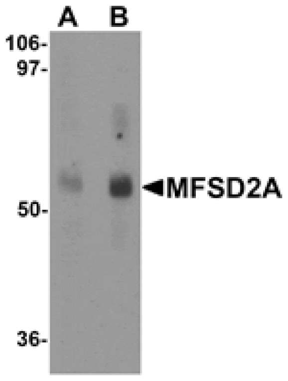 Western blot - MFSD2A Antibody from Signalway Antibody (25208) - Antibodies.com