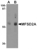 Western blot - MFSD2A Antibody from Signalway Antibody (25208) - Antibodies.com