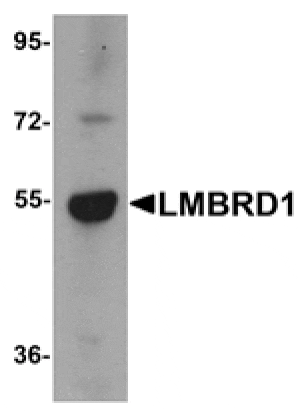 Western blot - LMBRD1 Antibody from Signalway Antibody (25216) - Antibodies.com