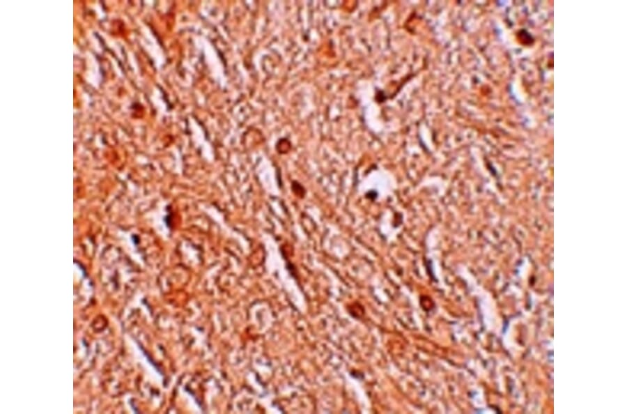 Immunohistochemistry - LMBRD1 Antibody from Signalway Antibody (25216) - Antibodies.com
