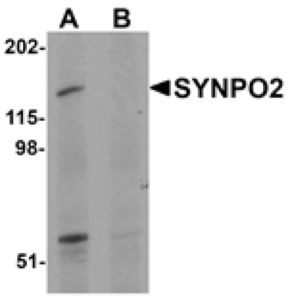 Western blot - SYNPO2 Antibody from Signalway Antibody (25218) - Antibodies.com