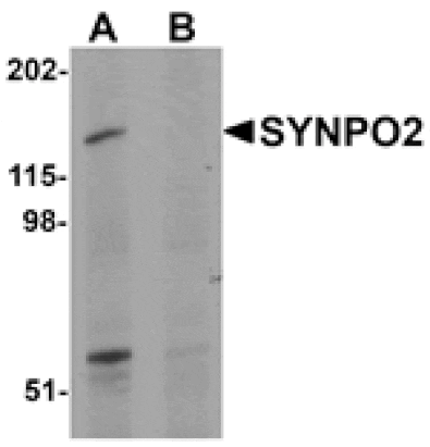 Western blot - SYNPO2 Antibody from Signalway Antibody (25218) - Antibodies.com