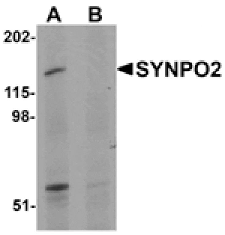 Western blot - SYNPO2 Antibody from Signalway Antibody (25218) - Antibodies.com