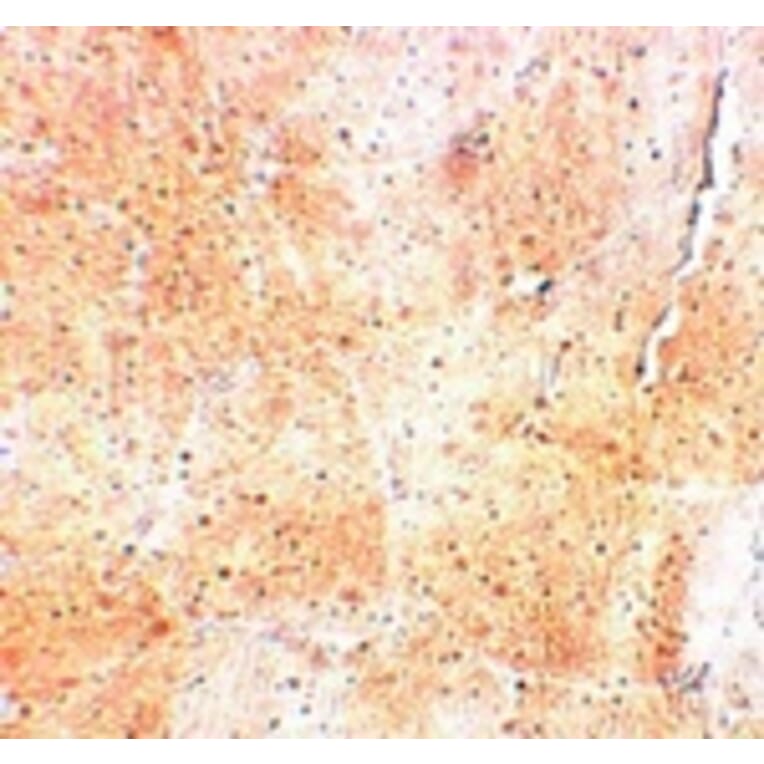 Immunohistochemistry - SYNPO2 Antibody from Signalway Antibody (25218) - Antibodies.com