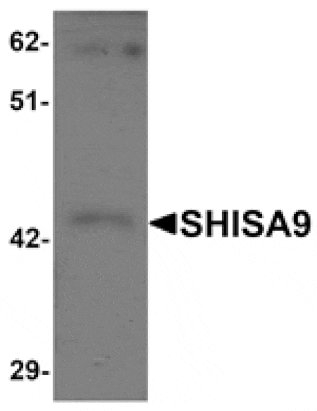 Western blot - SHISA9 Antibody from Signalway Antibody (25221) - Antibodies.com