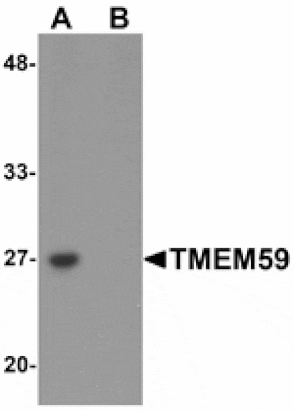 Western blot - TMEM59 Antibody from Signalway Antibody (25223) - Antibodies.com