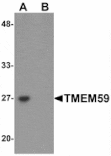 Western blot - TMEM59 Antibody from Signalway Antibody (25223) - Antibodies.com