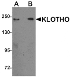 Western blot - KLOTHO Antibody from Signalway Antibody (25237) - Antibodies.com