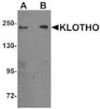 Western blot - KLOTHO Antibody from Signalway Antibody (25237) - Antibodies.com