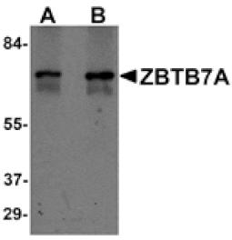 Western blot - ZBTB7A Antibody from Signalway Antibody (25246) - Antibodies.com