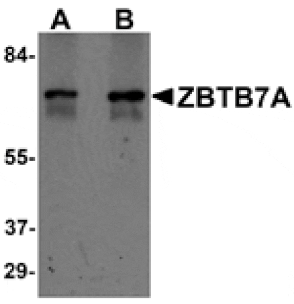 Western blot - ZBTB7A Antibody from Signalway Antibody (25246) - Antibodies.com