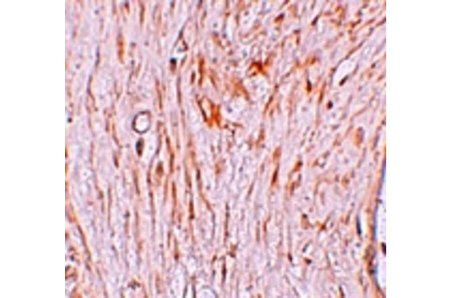Immunohistochemistry - ZBTB7A Antibody from Signalway Antibody (25246) - Antibodies.com